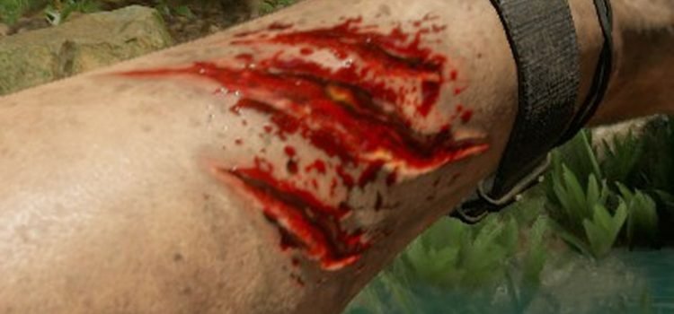 1200px-Lacerationclose_ups.jpg